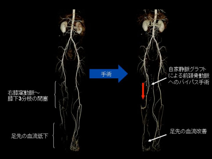 手術[image]