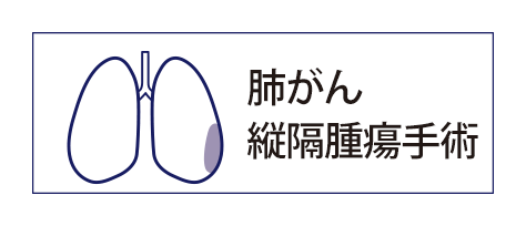 手術支援ロボット ダヴィンチ（da Vinci）による肺がん手術・縦隔腫瘍手術