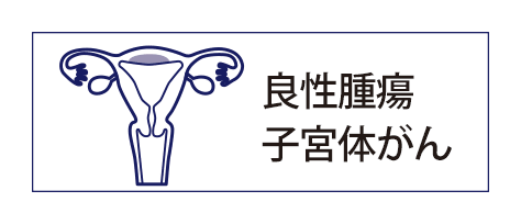 良性腫瘍に対する子宮全摘術および初期の子宮体がんに対する子宮全摘術＋骨盤リンパ節郭清