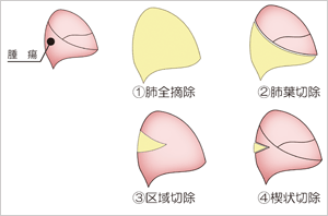 fig.5