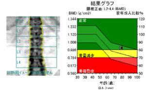 骨塩定量解析データ