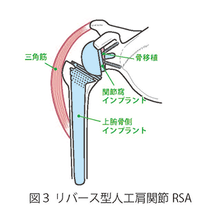 肩関節について 図3