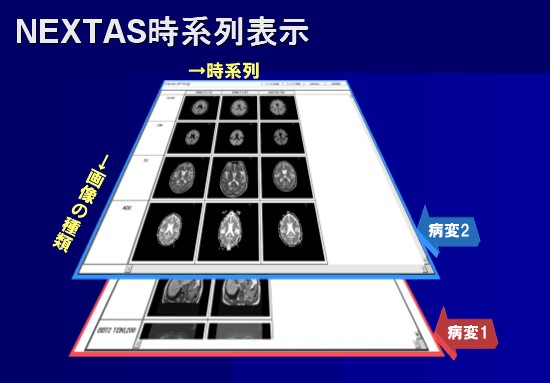 NEXTAS時系列表示