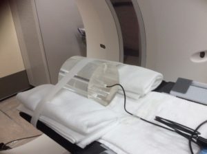 X線CT装置における線量測定(半年に1回)