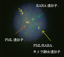 FISH法：CML(BCR/ABL)