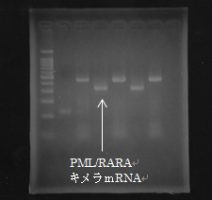 RT-PCR法：CML(Major BCR/ABL)