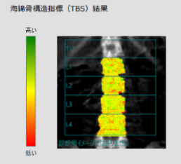 TBS解析