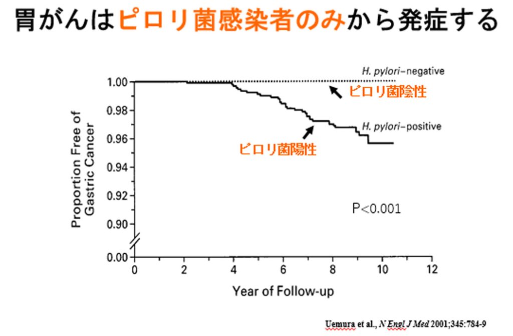 胃がんの内視鏡検診を解説!(前編) │ 倉敷中央病院Webマガジン-KCH Times